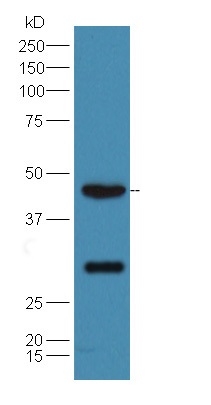 Western blot - Anti-LXR alpha + LXR beta antibody (AB216691)