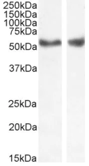 Western blot - Anti-LXR alpha + LXR beta antibody (AB24362)