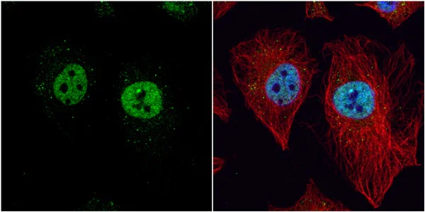 Immunocytochemistry/ Immunofluorescence - Anti-LXR beta/NER antibody (AB228867)
