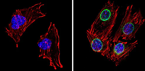 Immunocytochemistry/ Immunofluorescence - Anti-LXR beta/NER antibody (AB28479)