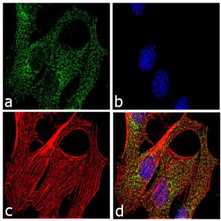 Immunocytochemistry/ Immunofluorescence - Anti-LXR beta/NER antibody (AB28479)