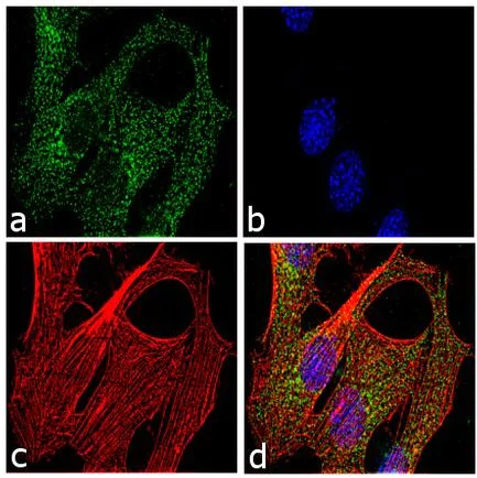 Immunocytochemistry/ Immunofluorescence - Anti-LXR beta/NER antibody (AB28479)