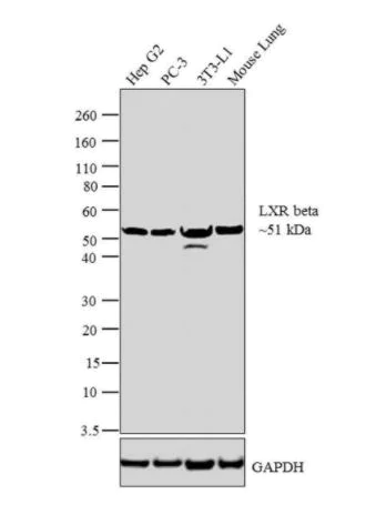 Western blot - Anti-LXR beta/NER antibody (AB28479)