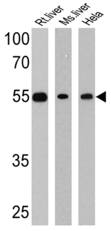 Western blot - Anti-LXR beta/NER antibody (AB28479)