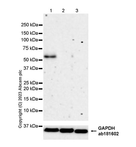 Western blot - Anti-LXR beta/NER antibody [EPR24051-104] (AB315082), expandable thumbnail
