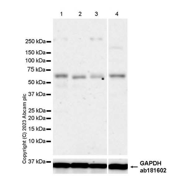 Western blot - Anti-LXR beta/NER antibody [EPR24051-104] (AB315082), expandable thumbnail