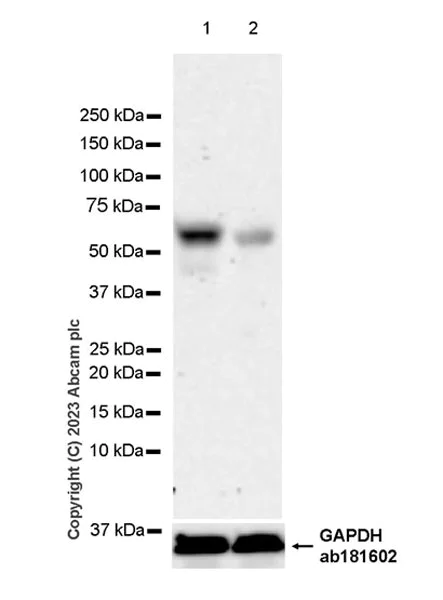 Western blot - Anti-LXR beta/NER antibody [EPR24051-104] - BSA and Azide free (AB315083)