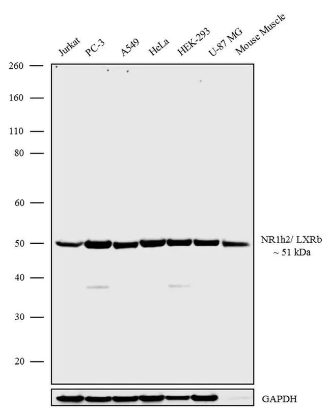Western blot - Anti-LXR beta/NER antibody [RP23040144] (AB308041)