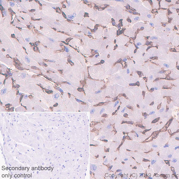 Immunohistochemistry (Formalin/PFA-fixed paraffin-embedded sections) - Anti-Ly-6A/E (Sca-1) antibody [EPR22502-68] (AB255604)