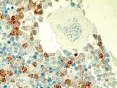 Immunohistochemistry (Formalin/PFA-fixed paraffin-embedded sections) - Anti-Ly-6A/E (Sca-1) antibody [EPR3355] - BSA and Azide free (AB239951)