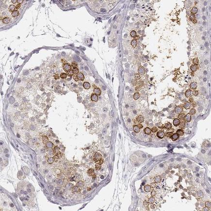 Immunohistochemistry (Formalin/PFA-fixed paraffin-embedded sections) - Anti-Ly-6K antibody (AB224402)