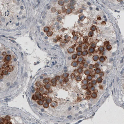 Immunohistochemistry (Formalin/PFA-fixed paraffin-embedded sections) - Anti-Ly-6K antibody [CL2433] (AB211873)