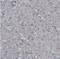 Immunohistochemistry (Formalin/PFA-fixed paraffin-embedded sections) - Anti-Ly-6K antibody [CL2433] (AB211873)