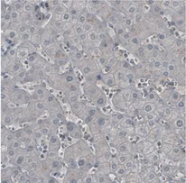 Immunohistochemistry (Formalin/PFA-fixed paraffin-embedded sections) - Anti-Ly-6K antibody [CL2433] (AB211873)