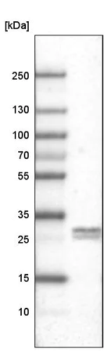 Western blot - Anti-Ly-6K antibody [CL2433] (AB211873)