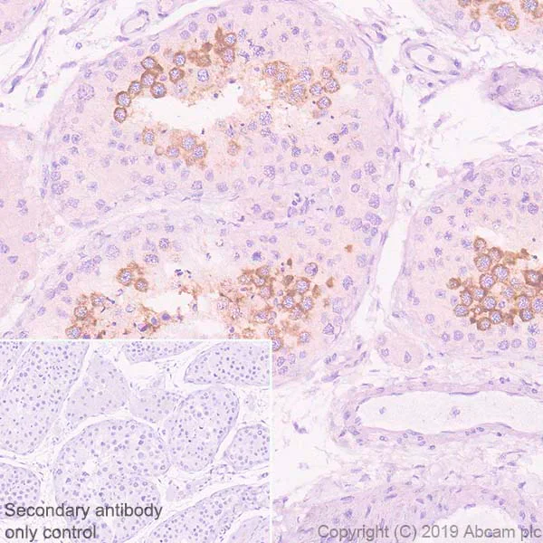 Immunohistochemistry (Formalin/PFA-fixed paraffin-embedded sections) - Anti-Ly-6K antibody [EPR23017-37] - BSA and Azide free (AB267795)