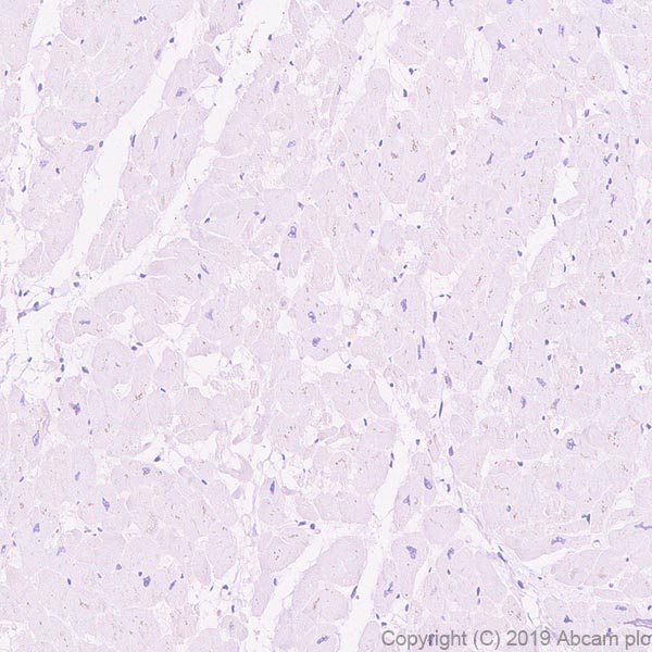 Immunohistochemistry (Formalin/PFA-fixed paraffin-embedded sections) - Anti-Ly-6K antibody [EPR23017-37] - BSA and Azide free (AB267795)
