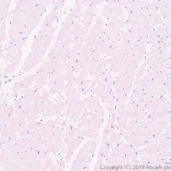 Immunohistochemistry (Formalin/PFA-fixed paraffin-embedded sections) - Anti-Ly-6K antibody [EPR23017-37] - BSA and Azide free (AB267795)