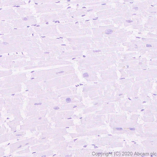Immunohistochemistry (Formalin/PFA-fixed paraffin-embedded sections) - Anti-Ly-6K antibody [EPR23021-61] (AB246486)