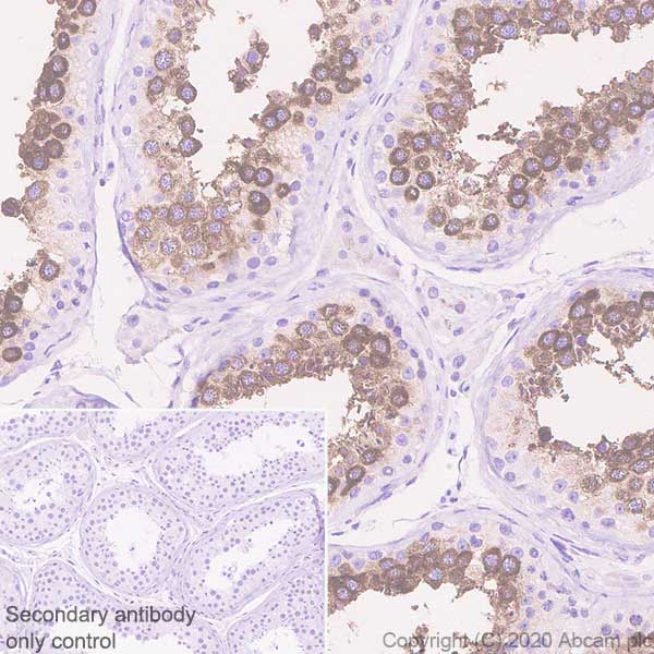 Anti-Ly-6K antibody [EPR23021-61] (ab246486) | Abcam