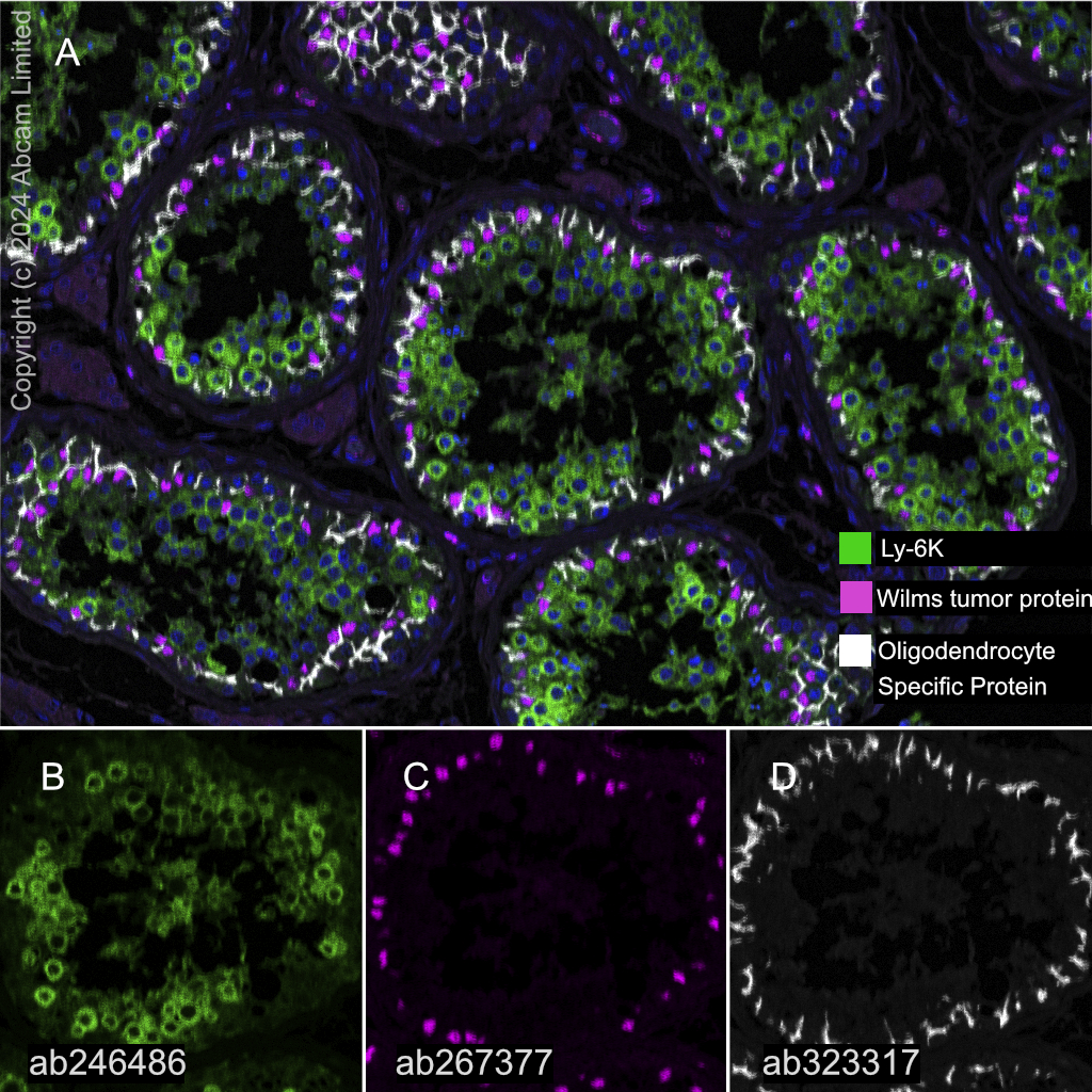 Multiplex immunohistochemistry - Anti-Ly-6K antibody [EPR23021-61] (AB246486)