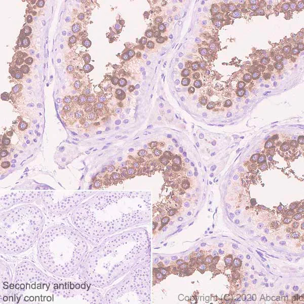 Immunohistochemistry (Formalin/PFA-fixed paraffin-embedded sections) - Anti-Ly-6K antibody [EPR23021-61] - BSA and Azide free (AB272394)