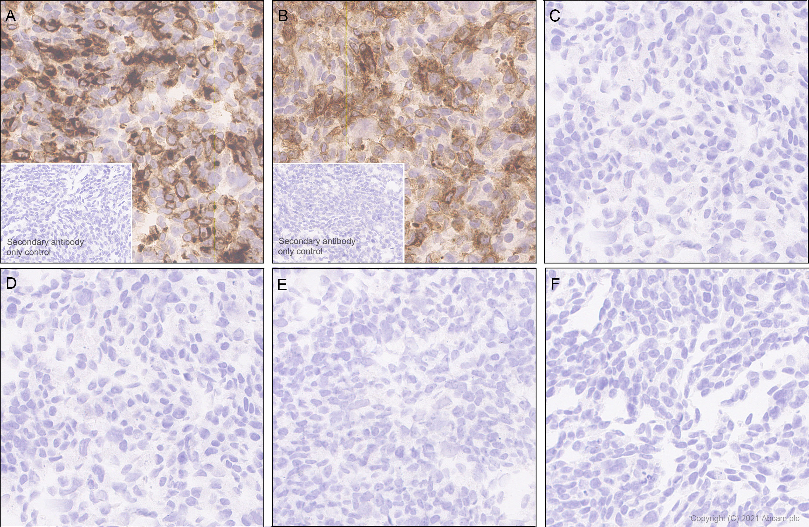 Immunohistochemistry (Formalin/PFA-fixed paraffin-embedded sections) - Anti-Ly6c antibody [EPR27220-23] - BSA and Azide free (AB314121), expandable thumbnail