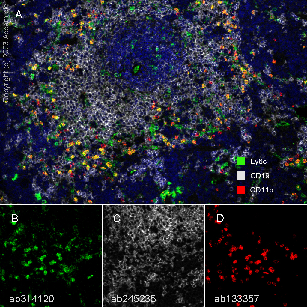 Multiplex immunohistochemistry - Anti-Ly6c antibody [EPR27220-23] - BSA and Azide free (ab314121), expandable thumbnail