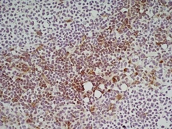 Immunohistochemistry (Frozen sections) - Anti-Ly6c antibody [ER-MP20] (AB54223)