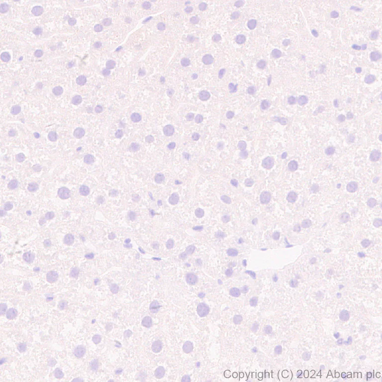 Immunohistochemistry (Formalin/PFA-fixed paraffin-embedded sections) - Anti-LY6C antibody [RM1151] - BSA and Azide free (AB317273)