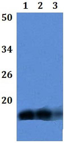 Western blot - Anti-LY6E/SCA-2 antibody (AB201098)
