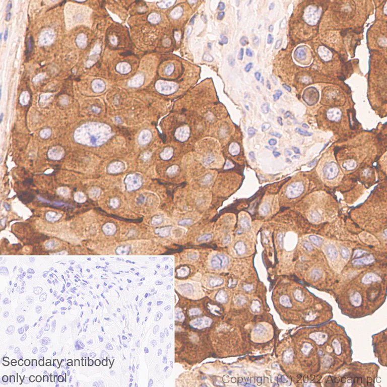 Immunohistochemistry (Formalin/PFA-fixed paraffin-embedded sections) - Anti-LY6E/SCA-2 antibody [EPR26038-105] (AB300399)