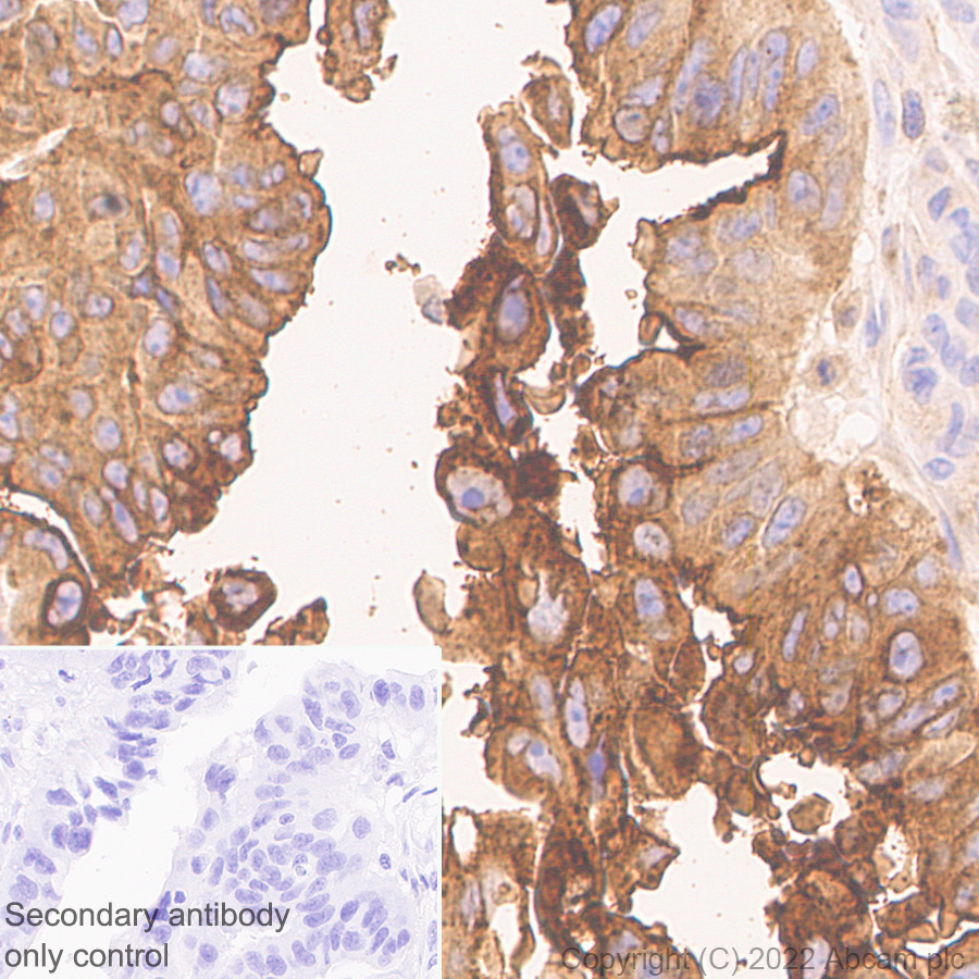Immunohistochemistry (Formalin/PFA-fixed paraffin-embedded sections) - Anti-LY6E/SCA-2 antibody [EPR26038-105] (AB300399)
