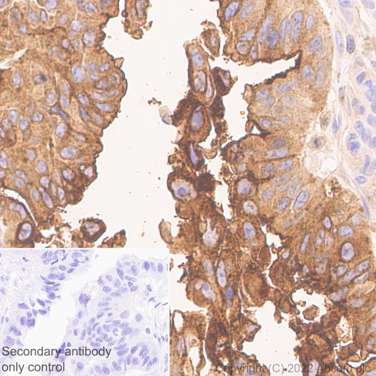Immunohistochemistry (Formalin/PFA-fixed paraffin-embedded sections) - Anti-LY6E/SCA-2 antibody [EPR26038-105] (AB300399)