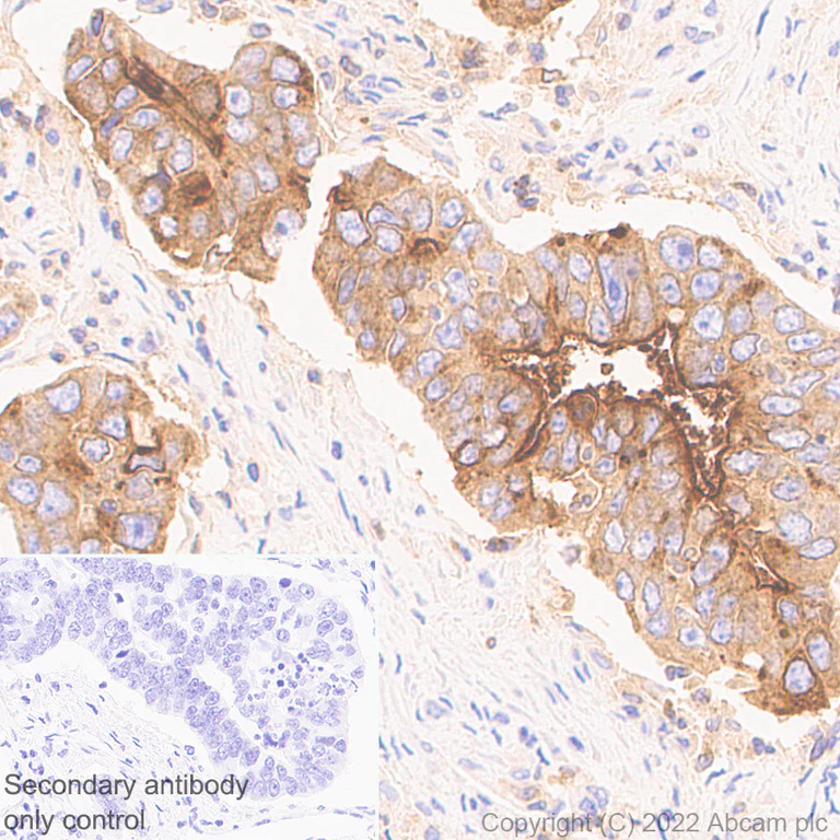 Immunohistochemistry (Formalin/PFA-fixed paraffin-embedded sections) - Anti-LY6E/SCA-2 antibody [EPR26038-105] (AB300399)