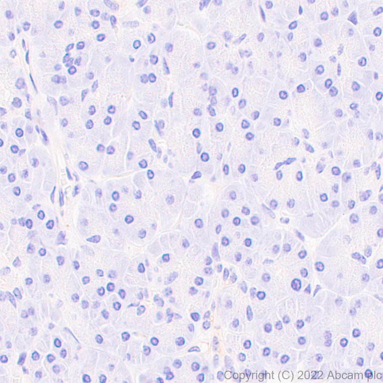 Immunohistochemistry (Formalin/PFA-fixed paraffin-embedded sections) - Anti-LY6E/SCA-2 antibody [EPR26038-105] (AB300399)