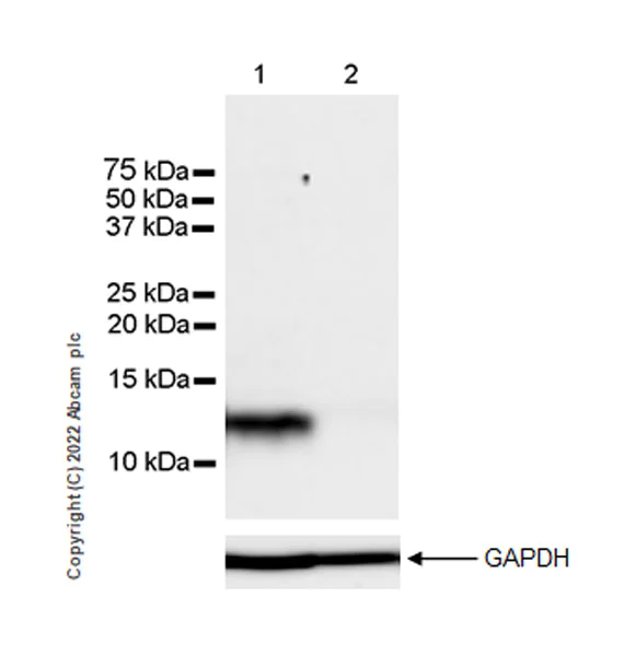 Western blot - Anti-LY6E/SCA-2 antibody [EPR26038-105] (AB300399)
