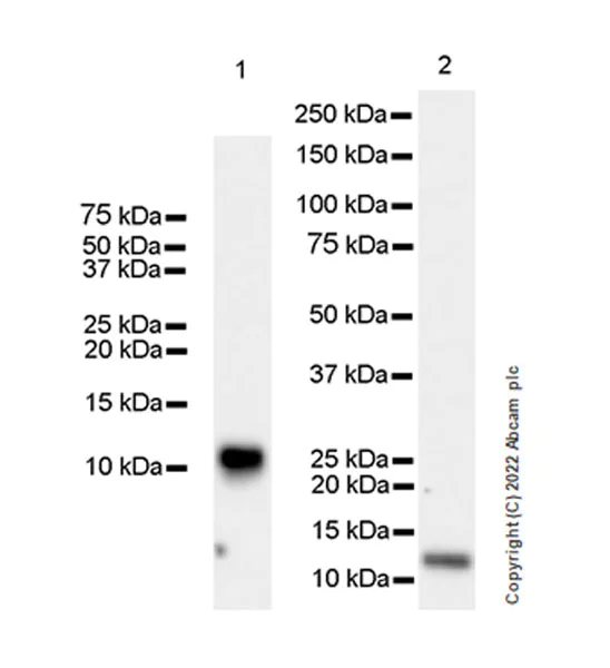 Western blot - Anti-LY6E/SCA-2 antibody [EPR26038-105] (AB300399)