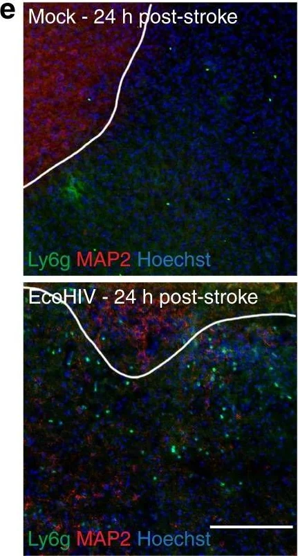 Immunohistochemistry - Anti-Ly6g + Ly6c antibody [RB6-8C5] (AB25377)