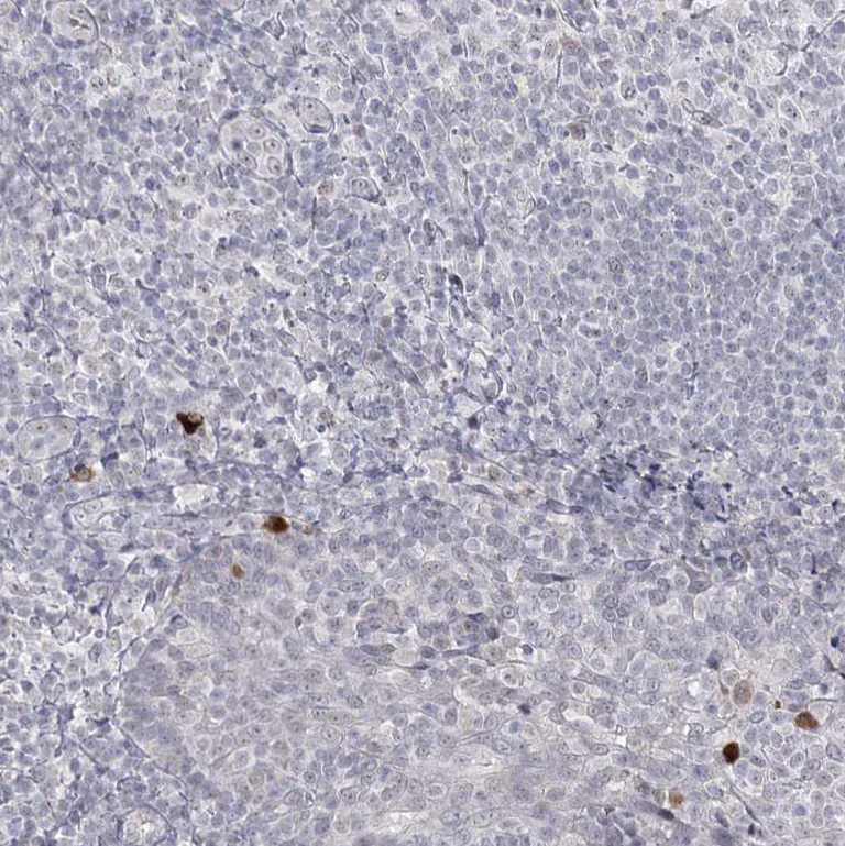 Immunohistochemistry (Formalin/PFA-fixed paraffin-embedded sections) - Anti-LY6G5C antibody (AB122501)
