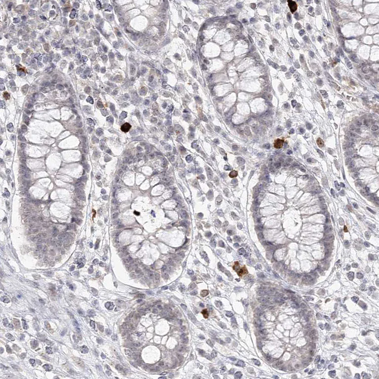 Immunohistochemistry (Formalin/PFA-fixed paraffin-embedded sections) - Anti-LY6G5C antibody (AB122501)