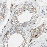Immunohistochemistry (Formalin/PFA-fixed paraffin-embedded sections) - Anti-LY6G6F antibody (AB121272)