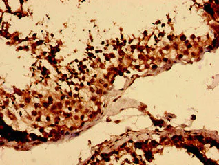 Immunohistochemistry (Formalin/PFA-fixed paraffin-embedded sections) - Anti-LY6H antibody (AB238875)