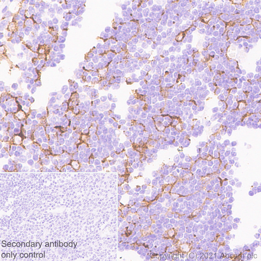 Immunohistochemistry (Formalin/PFA-fixed paraffin-embedded sections) - Anti-LY75/DEC-205 antibody [EPR5233] (AB124897), expandable thumbnail