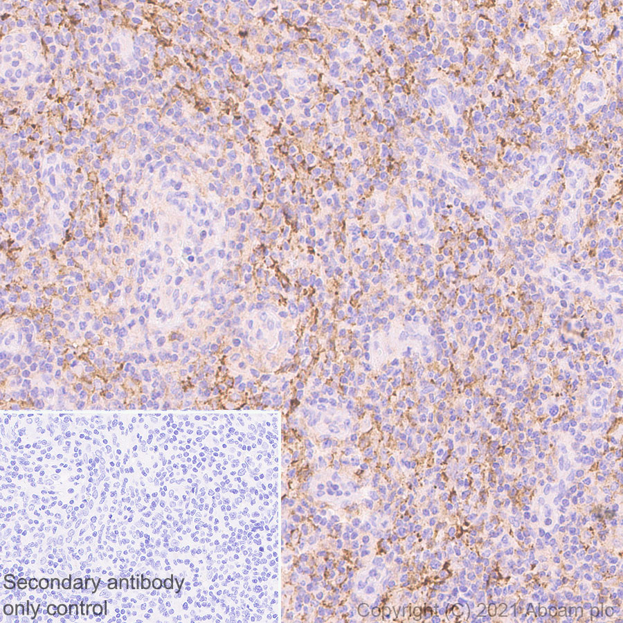 Immunohistochemistry (Formalin/PFA-fixed paraffin-embedded sections) - Anti-LY75/DEC-205 antibody [EPR5233] (AB124897), expandable thumbnail