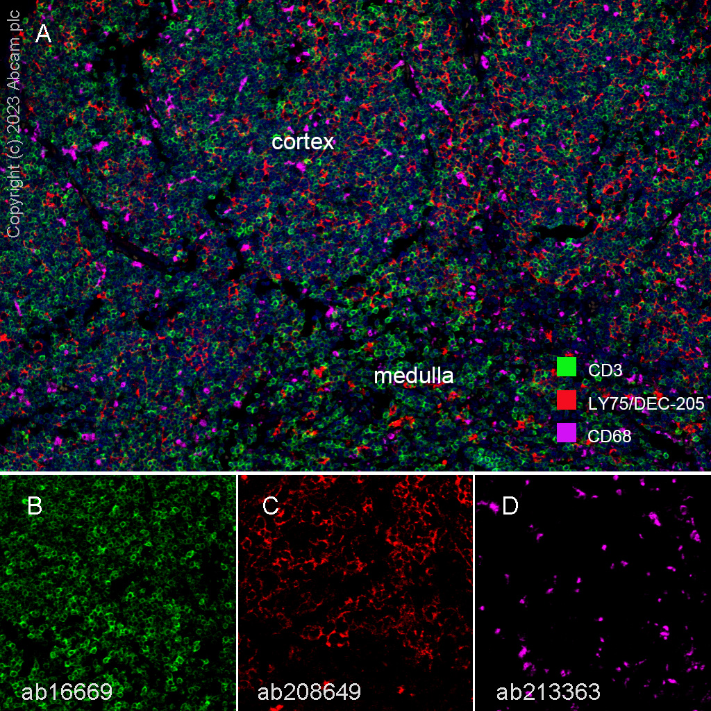 Multiplex immunohistochemistry - Anti-LY75/DEC-205 antibody [EPR5233] (AB124897), expandable thumbnail
