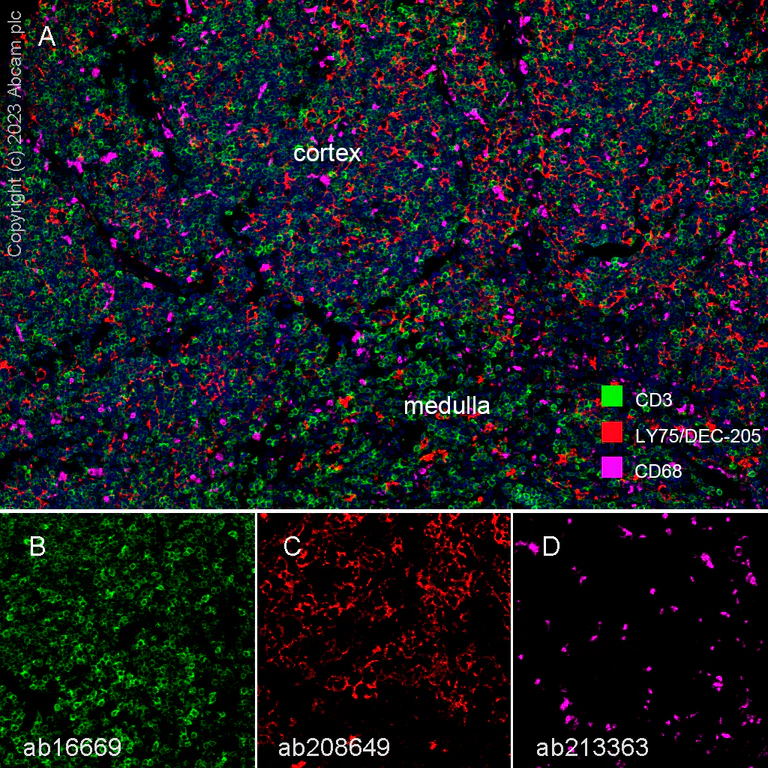 Multiplex immunohistochemistry - Anti-LY75/DEC-205 antibody [EPR5233] - BSA and Azide free (AB208649)