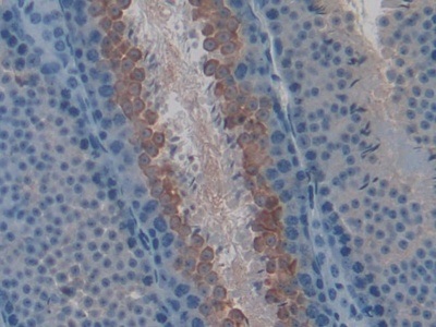 Immunohistochemistry (Formalin/PFA-fixed paraffin-embedded sections) - Anti-LYAR antibody (AB233082)