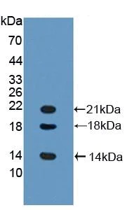 Western blot - Anti-LYAR antibody (AB233082)