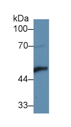 Western blot - Anti-LYAR antibody (AB233082)